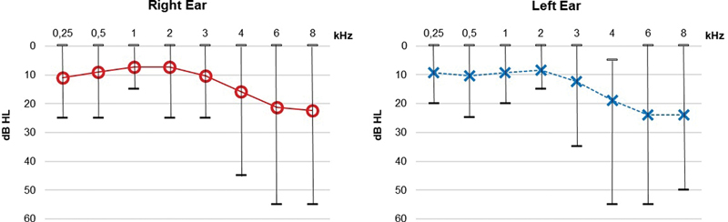 Peripheral Auditory Pathway and ABR Characterization in Adults with Williams Syndrome.
