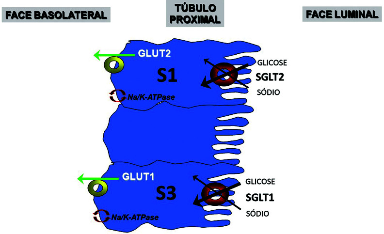 Sodium-glucose cotranspor ter 2 (SGLT2) inhibitors in nephrolithiasis: should we "gliflozin" patients with kidney stone disease?