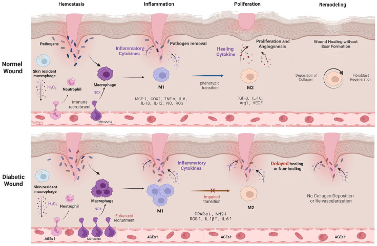 Immunomodulation in diabetic wounds healing: The intersection of macrophage reprogramming and immunotherapeutic hydrogels.