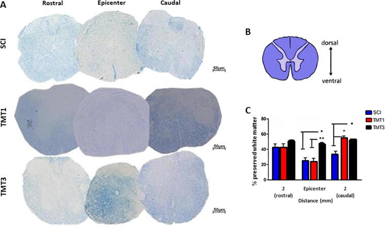 Exercise Volume Can Modulate the Regenerative Response to Spinal Cord Injury in Mice.