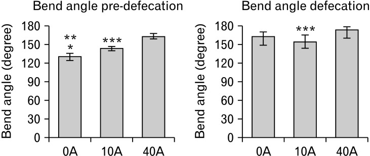 Consistency of Feces Affects Defecatory Function.