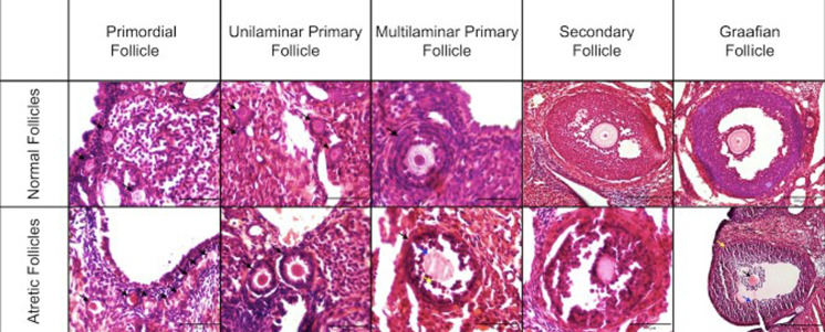 Dehydroepiandrosterone modulates the PTEN/PI3K/AKT signaling pathway to alleviate 4-vinylcyclohexene diepoxide-induced premature ovarian insufficiency in rats.