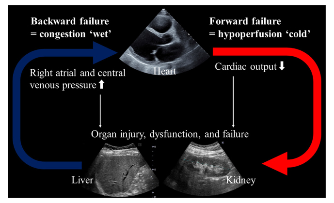 Organ injury and its management in heart failure: Liver, kidney, and thyroid gland dysfunction.