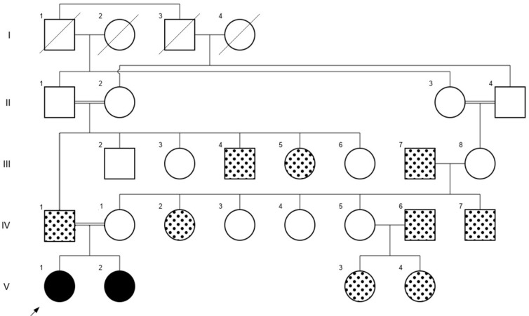 A Case Report of Parental Germline Mosaicism in the <i>PCDH19</i> Gene of Two Iranian Siblings.