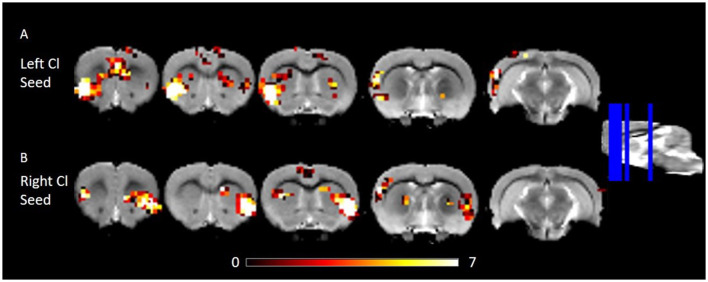 Erratum: Resting state functional connectivity of the rat claustrum.