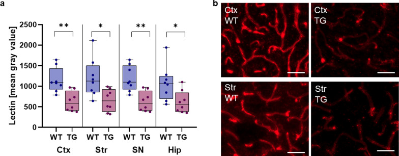 Blood-brain barrier alterations and their impact on Parkinson's disease pathogenesis and therapy.