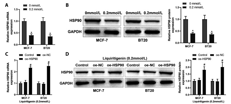 Polygonatum sibiricum component liquiritigenin restrains breast cancer cell invasion and migration by inhibiting HSP90 and chaperone-mediated autophagy.