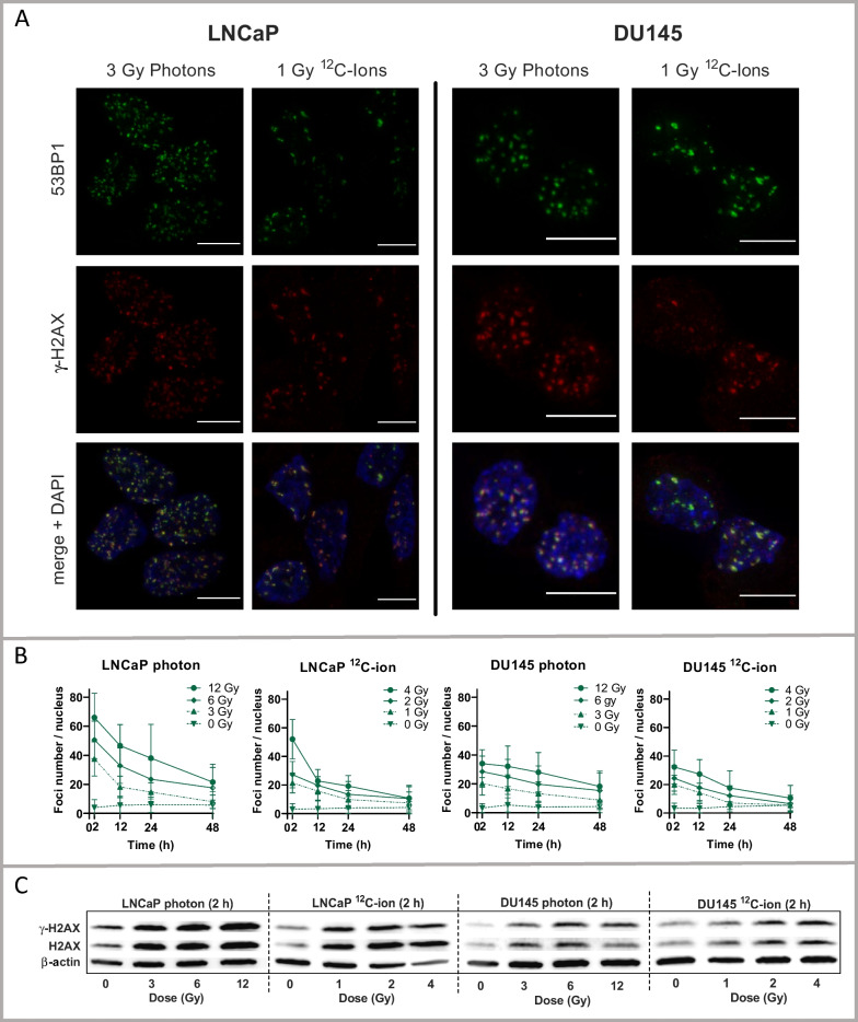 Transcriptomic response of prostate cancer cells to carbon ion and photon irradiation with focus on androgen receptor and TP53 signaling.