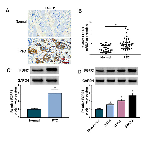 Identification of mechanism of the oncogenic role of FGFR1 in papillary thyroid carcinoma.