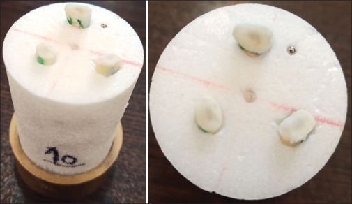 Evaluation of dimensional changes in EndoSeal mineral trioxide aggregate and AH Plus sealers using micro-computed tomography imaging.