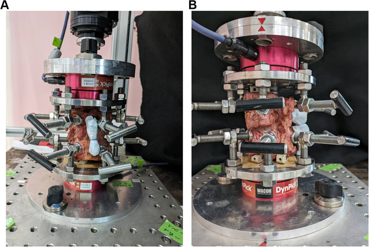 Biomechanical Characteristics of Kissing Spine During Extension Using a Human Cadaveric Lumbar Spinal Model.