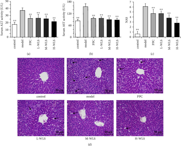 Wulingsan Alleviates MAFLD by Activating Autophagy via Regulating the AMPK/mTOR/ULK1 Signaling Pathway.