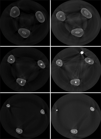 Evaluation of dimensional changes in EndoSeal mineral trioxide aggregate and AH Plus sealers using micro-computed tomography imaging.