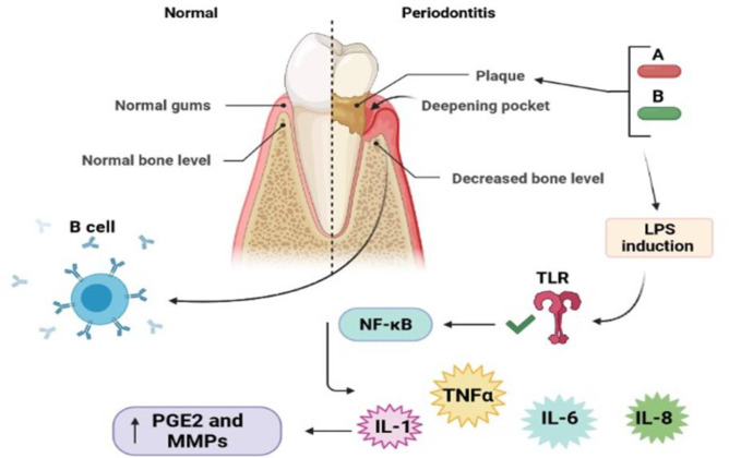 Herbal and nano-based herbal medicine: New insights into their therapeutic aspects against periodontitis.
