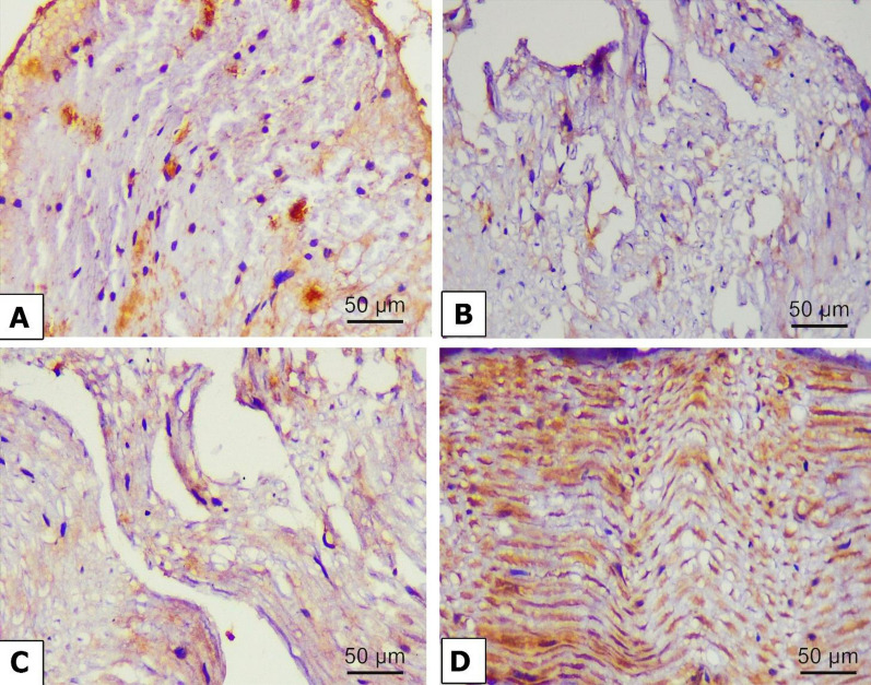Chrysin-loaded PEGylated liposomes protect against alloxan-induced diabetic neuropathy in rats: the interplay between endoplasmic reticulum stress and autophagy.
