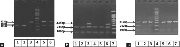 Genetic analysis: Therapeutic drug monitoring of metformin and glimepiride on diabetic patients' plasma including genetic polymorphism.
