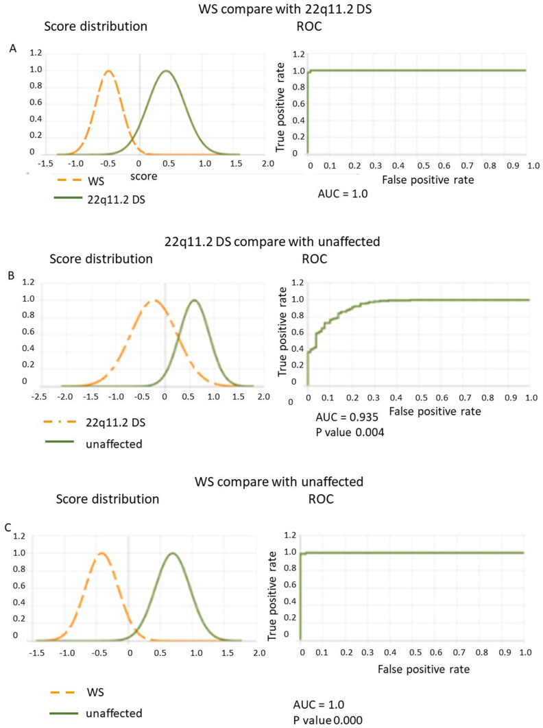 Comparison of the Accuracy in Provisional Diagnosis of 22q11.2 Deletion and Williams Syndromes by Facial Photos in Thai Population Between De-Identified Facial Program and Clinicians.