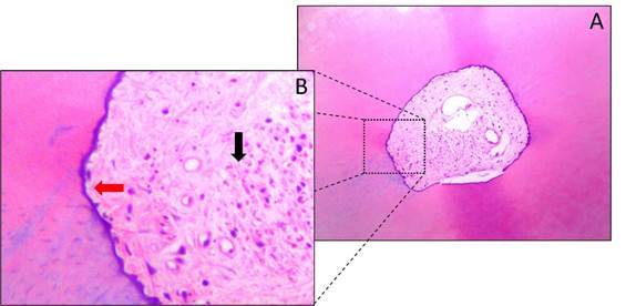 Debridement ability of the WaveOne Gold and TruNatomy systems in the apical third of root canals: ex vivo assessment.