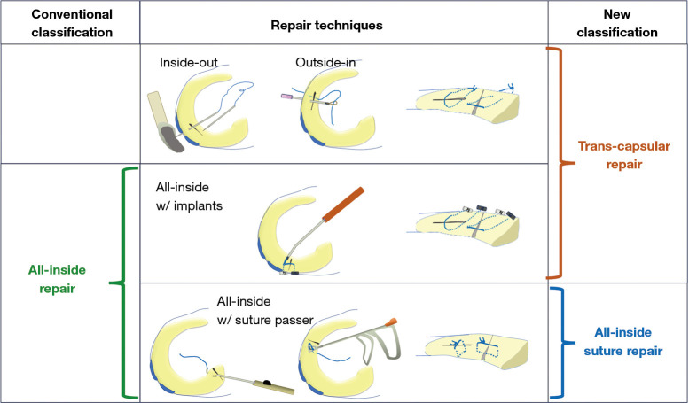 All-inside suture meniscal repair using suture passer.