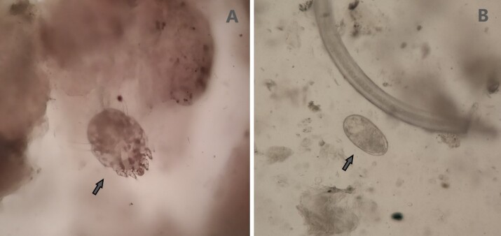 Epidemiology of sarcoptic mange in free-ranging vicuñas (Vicugna vicugna): a cross-sectional study in Andean highland communities in Peru.