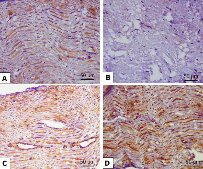 Chrysin-loaded PEGylated liposomes protect against alloxan-induced diabetic neuropathy in rats: the interplay between endoplasmic reticulum stress and autophagy.