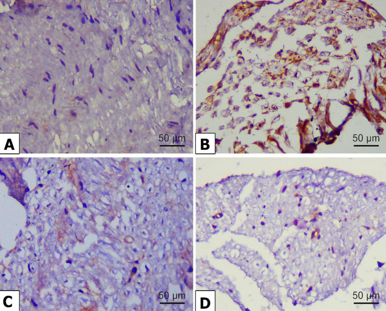 Chrysin-loaded PEGylated liposomes protect against alloxan-induced diabetic neuropathy in rats: the interplay between endoplasmic reticulum stress and autophagy.