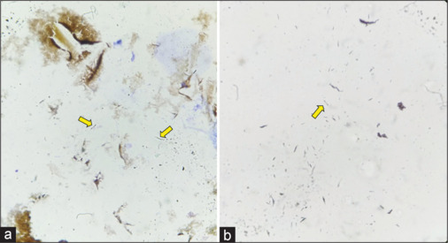Isolation, identification, and quantification of <i>Prevotella intermedia</i> and <i>Prevotella nigrescens</i> in subgingival plaque samples of periodontally healthy and chronic periodontitis patients through chromogenic <i>in situ</i> hybridization.