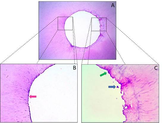 Debridement ability of the WaveOne Gold and TruNatomy systems in the apical third of root canals: ex vivo assessment.