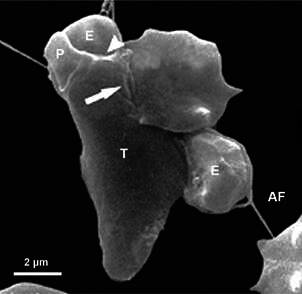 Endocytosis in anaerobic parasitic protists.