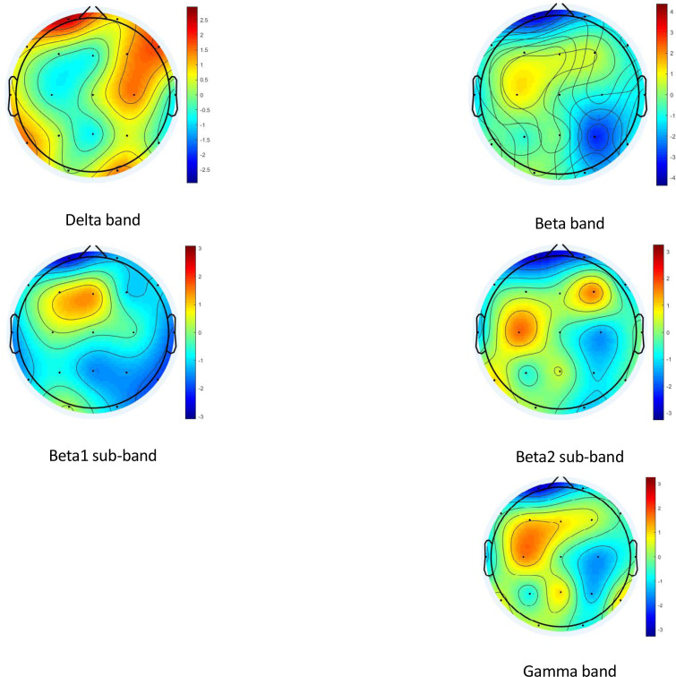 Effect of Low-intensity Transcranial Magnetic Stimulation on Response Inhibition of Adults With Attention-deficit/Hyperactivity Disorder.