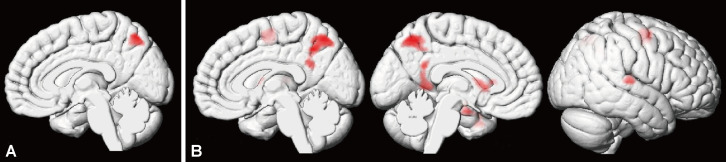 The Relationship Between Brain Activation for Taking Others' Perspective and Interoceptive Abilities in Autism Spectrum Disorder: An fMRI Study.