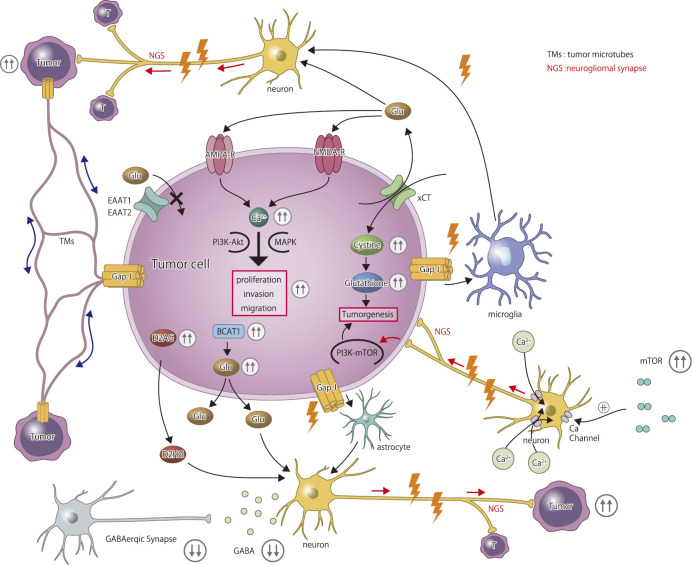 Epilepsy in Patients with Gliomas.