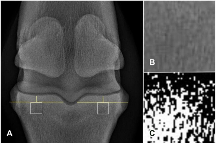 Radiographic texture of the trabecular bone of the proximal phalanx in horses with metacarpophalangeal osteoarthritis.