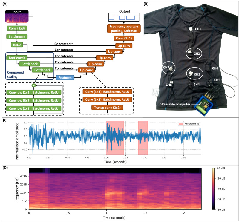 Multiscale Bowel Sound Event Spotting in Highly Imbalanced Wearable Monitoring Data: Algorithm Development and Validation Study.