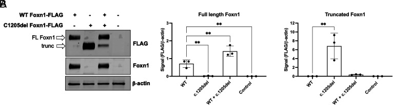 Peripheral T Cell Development and Immunophenotyping of Twins with Heterozygous FOXN1 Mutations.