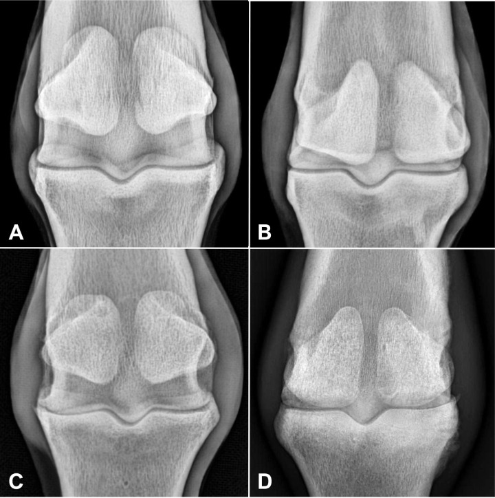 Radiographic texture of the trabecular bone of the proximal phalanx in horses with metacarpophalangeal osteoarthritis.