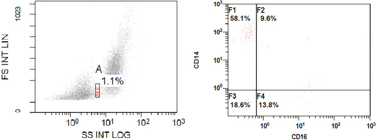 A pilot study of monocytes in relapsing remitting multiple sclerosis: Correlation with disease activity.
