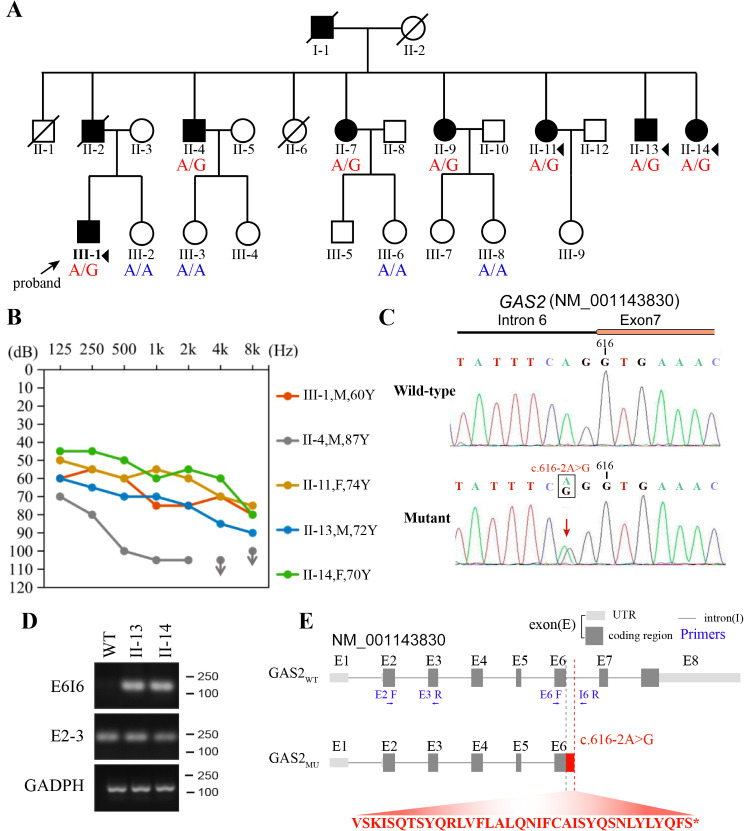 A novel variant in GAS2 is associated with autosomal dominant nonsyndromic hearing impairment in a Chinese family.
