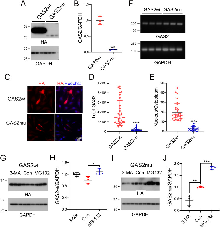 A novel variant in GAS2 is associated with autosomal dominant nonsyndromic hearing impairment in a Chinese family.