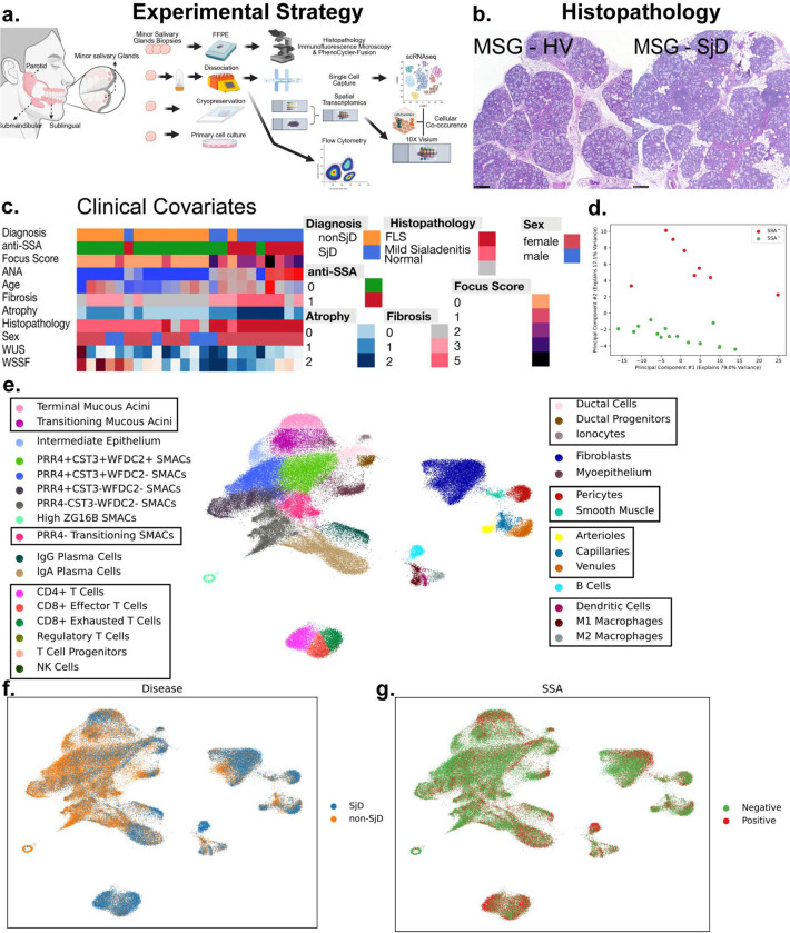 GZMK+CD8+ T cells Target A Specific Acinar Cell Type in Sjögren's Disease.