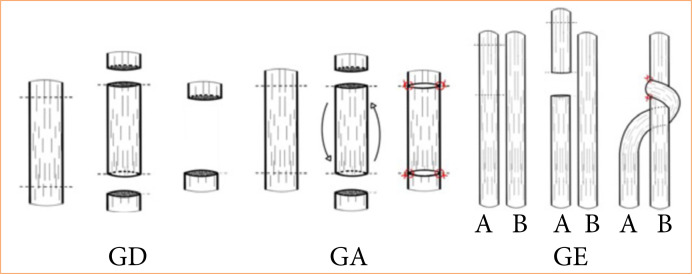 End-to-side neurorrhaphy in the reconstruction of peripheral segmental neural loss: an experimental study.