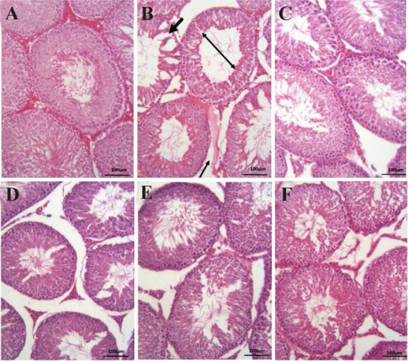 The Protective Effects of Citrulline on Testicular Injury Induced by Torsion and Detorsion in Adult Male Rats: An Experimental Study.