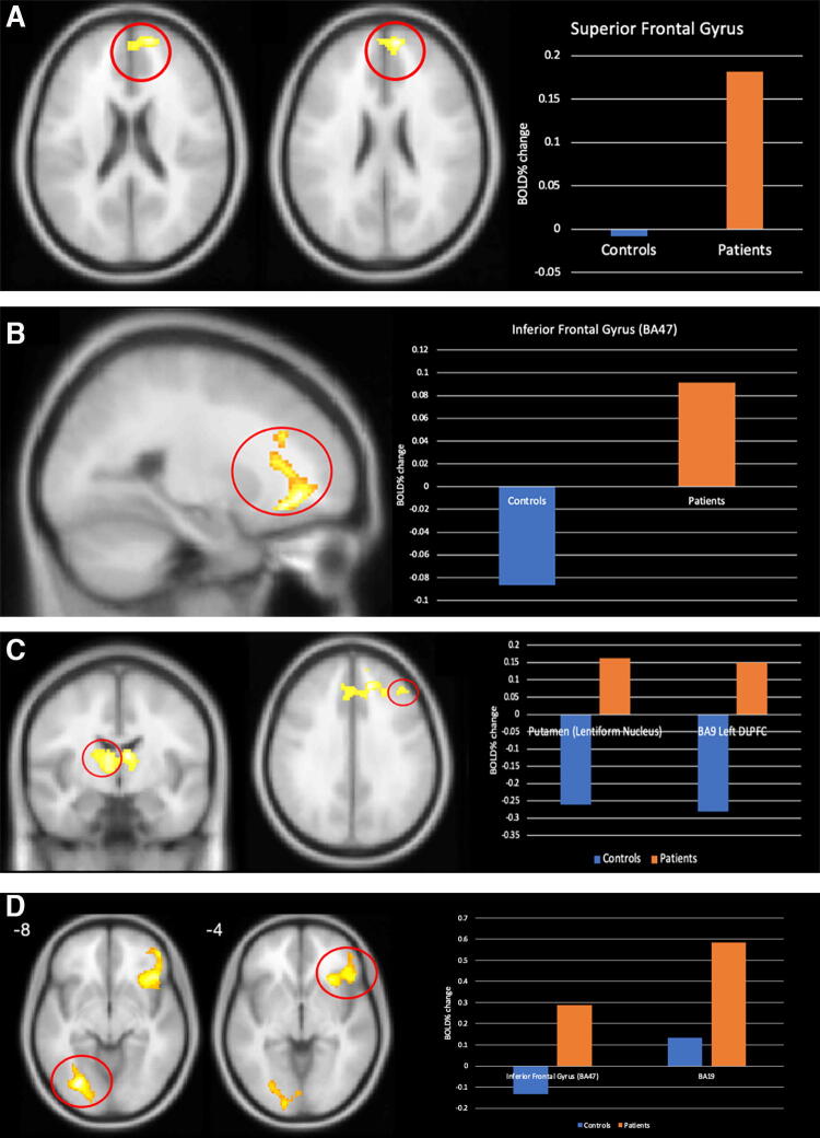 Assessment of Oculomotor Functions as a Biomarker in Mild Traumatic Brain Injury.
