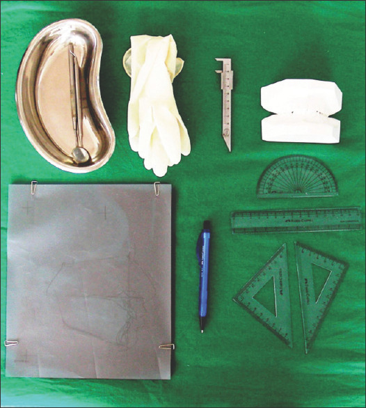 Assessment of Factors Associated with Mandibular Anterior Crowding in Mixed Dentition.