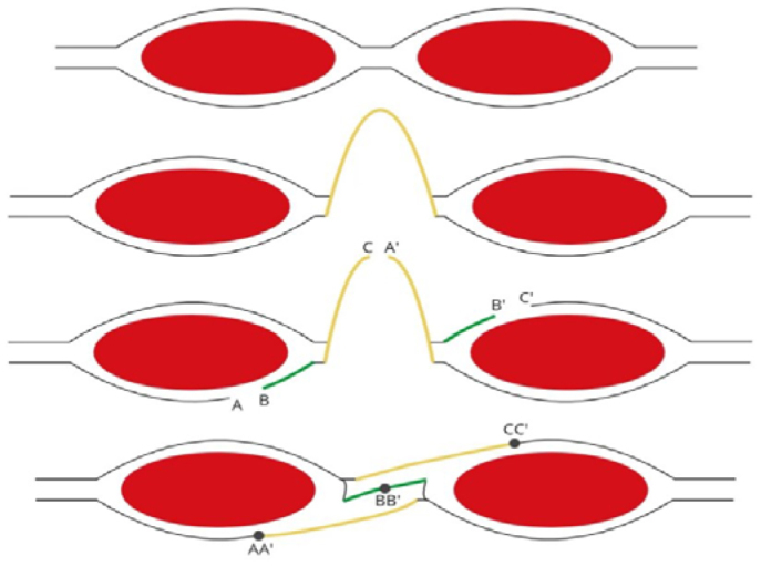 INTRA-ABDOMINAL PRESSURE MONITORING DURING LÁZARO DA SILVA'S PROCEDURE FOR VENTRAL HERNIA REPAIR: A CROSS-SECTIONAL STUDY.