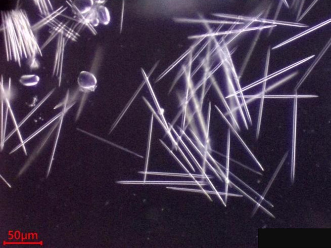 <i>Alocasia odora</i> poisoning due to calcium oxalate needle crystals in Japan.