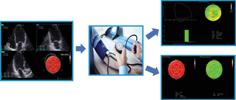 Clinical Applications of Myocardial Work in Echocardiography: A Comprehensive Review.