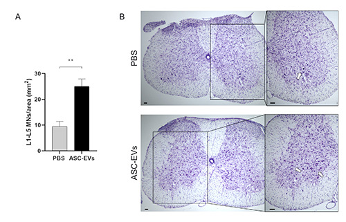 Adipose mesenchymal stem cells-derived extracellular vesicles exert their preferential action in damaged central sites of SOD1 mice rather than peripherally.