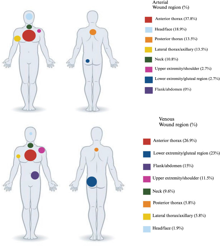 Diagnostic and therapeutic considerations in cases of civilian intravascular ballistic embolism: a review of case reports.