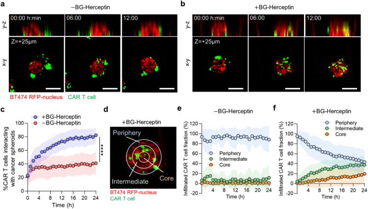 CAR T cell infiltration and cytotoxic killing within the core of 3D breast cancer spheroids under the control of antigen sensing in microwell arrays.